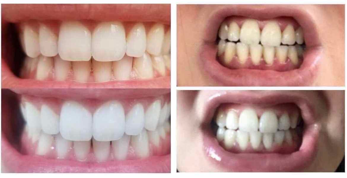 AP24 Whitening Toothpaste